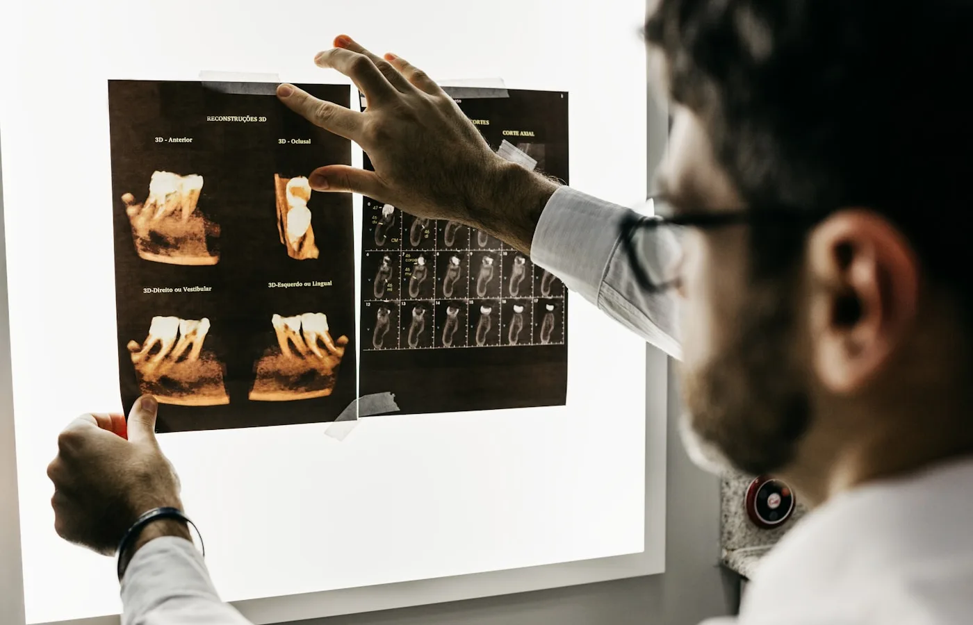 Dentist reviewing patient dental scans